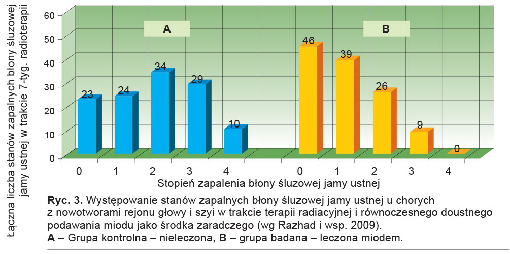 Występowanie stanów zapalnych błony śluzowej jamy ustnej u chorych 