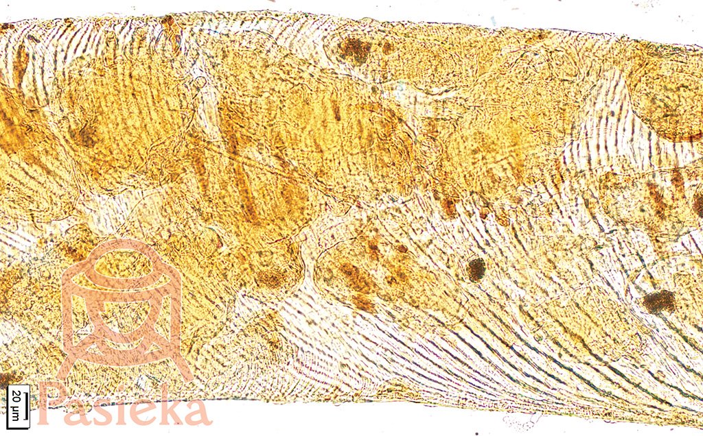 Pasieka nr 96 ([PAS96], lipiec - sierpień 2019, n2_Fot_4_Tchawka_z_widocznymi_wewnatrz_Acarapis_woodi)